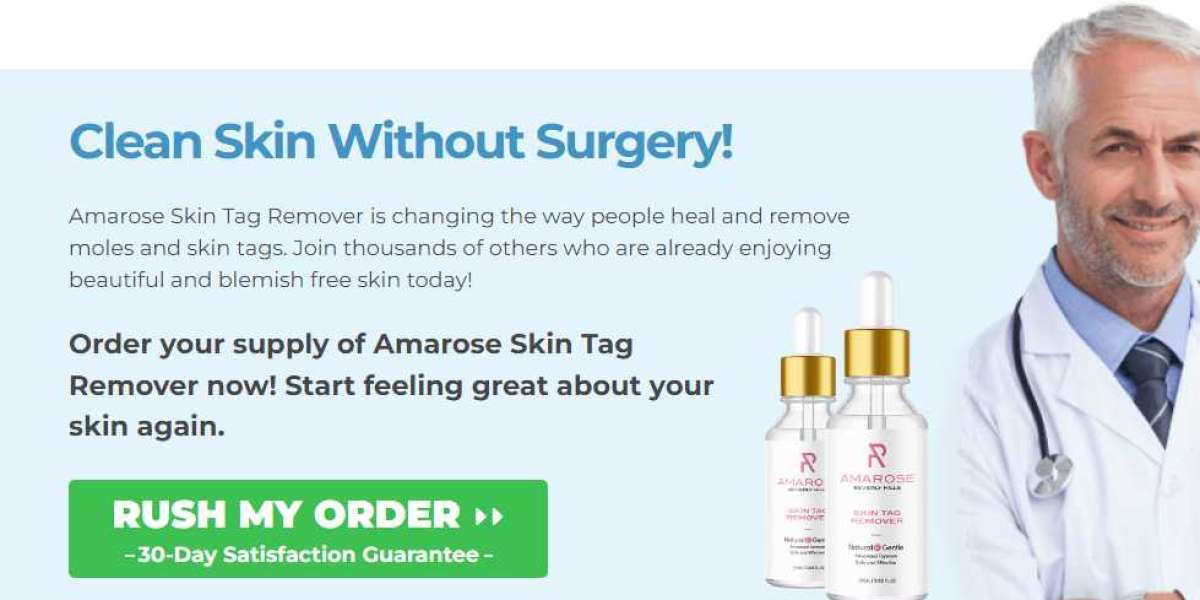 Ten Things You Should Know About Amarose Skin Tag Remover Reviews?