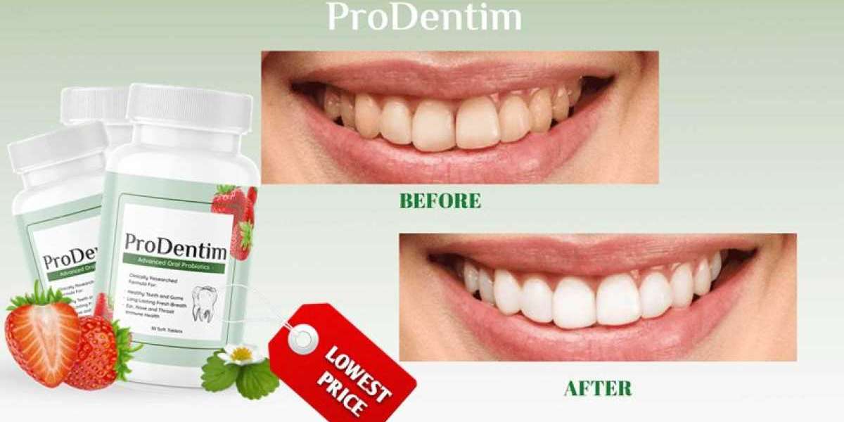 ProDentim || Pro Dentim Reviews: That Work Or Ingredients?