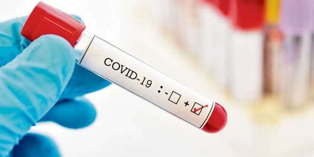 Covid Antibody Test in North Hills