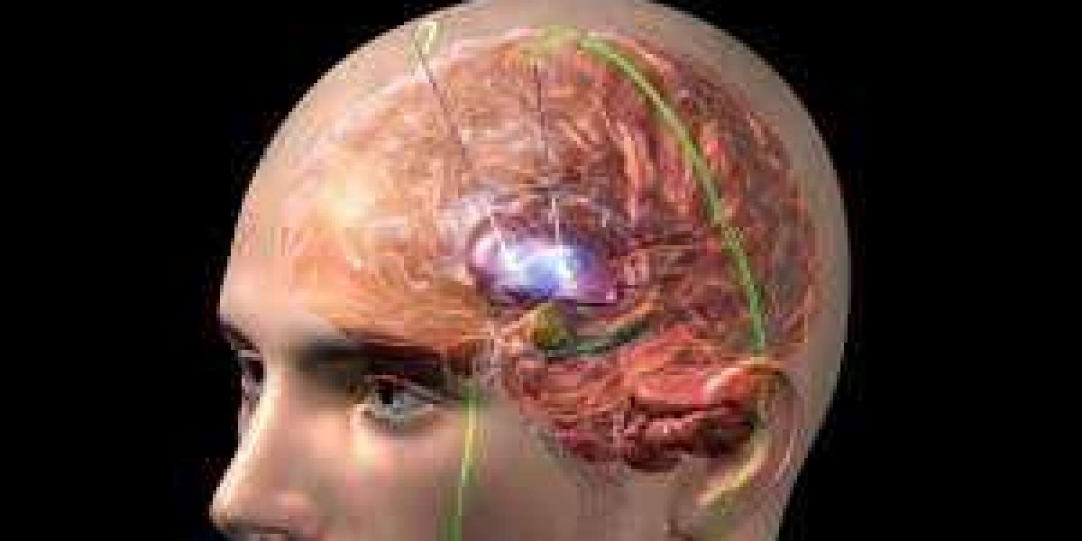 Deep Brain Stimulation Devices Market Outlook, Share, Trends, And Forecast 2030